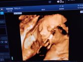 3-D фото 29 недель.