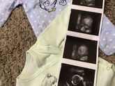 Фотографии на 23 неделе беременности