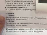 Вторая зб((