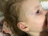 Ударилась виском об угол