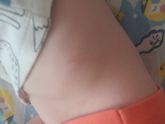 На что аллергия?