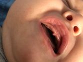 Зубы