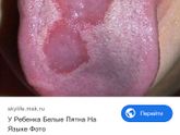 У сына появились такие