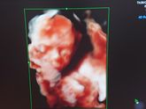 Наши 20 недель ♥ Вторая Б🤰