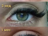 Пошли бы на ресницы при боли нерва в зубе?
