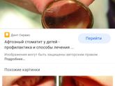 Похоже мы подхватили стоматит.