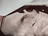 Кто-Нибудь разбирается в снимках