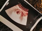 Всем добрый вечер)Буквально вчера