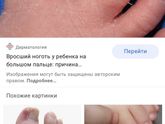 Ногти на ногах у новорождённого