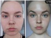 Омоложение лица Девочки