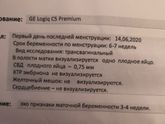 Хгч