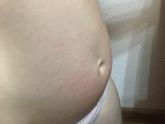 Аллергия или нет?