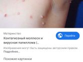 Сос! У кого были папиломы?