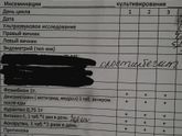 Начало схемы на ВМИ со стимуляцией