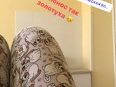 Не понос так золотуха 😬