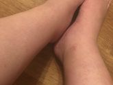 Подскажите что делать, ноги