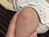 У нас переодически вылазят