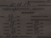 Узи в 27 недель