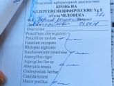 Аллергия, выяснили на что.
