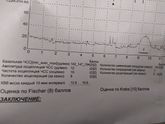 35-36 нед. КТГ 8 БАЛЛОВ:( Децелерации (3)