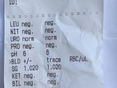 Анализ мочи, BLD +/- trace RBC/uL