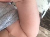 Вчера высыпало по всему