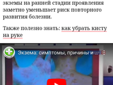 Волдыри на руках