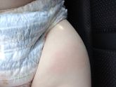 Девочки подскажите, пожалуйста, позавчера