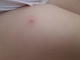 Вчера поставили акдс