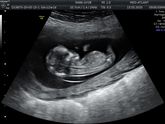 BABY 2. Мы знаем, кто там 🤰