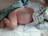 Животик вздут, напрягаемся, пукаем