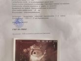 Девочки, вчера УЗИ сделала,