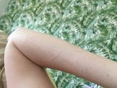Странные царапины на руках