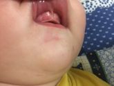 Девочки! Это зубы скоро??? Или нет? (Фото)