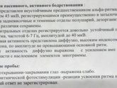 Помогите расшифровать ЭЭГ?