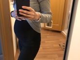 2 скрининг, расширение Лоханок почек плода.