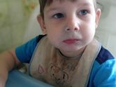 Синий носогубный треугольник