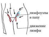 Воспалился лимфоузел либо вена