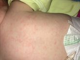 Девочки по совету педиатра