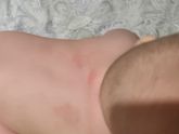 Девочки, у малыша появились