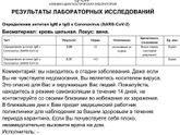 Положительный КОВИД??