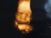 3-D фото 29 недель.