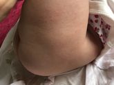 Девочки мы начали использовать