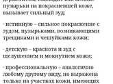 Волдыри на руках
