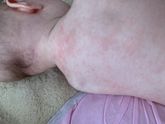 Девочки,к врачу записали нас