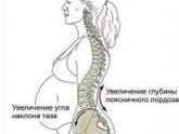 Позвоночник после беременности