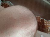 Сейчас приходила врач, поставила