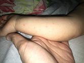 У кого так было?Скажите