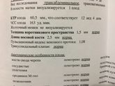 Поздний эмбрион...