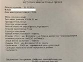 Овуляция после БХБ